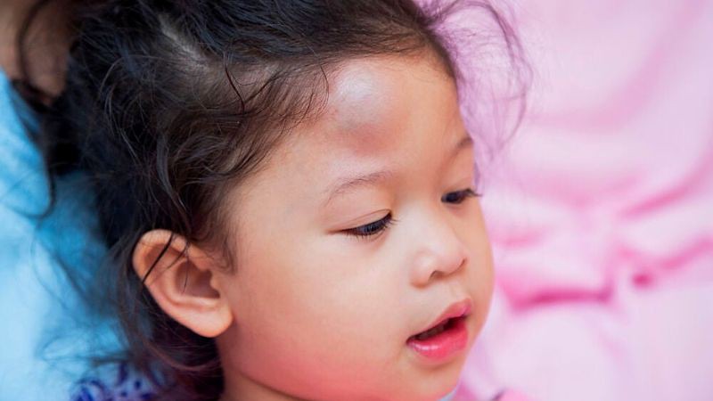 Chấn thương ở đầu